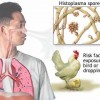 histoplasmosis1
