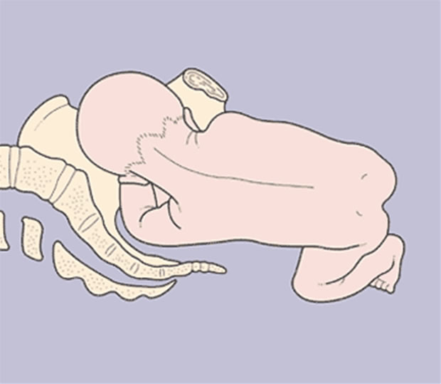 pelvic fetal position pelvic fetal position